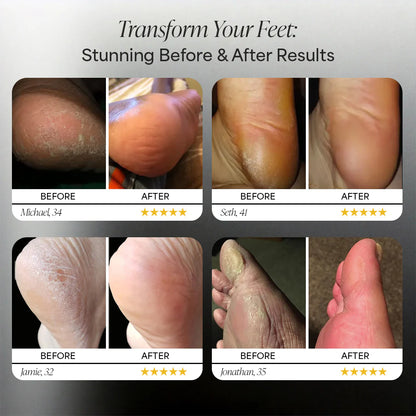 Smoovay™ Electric Foot Callus Remover